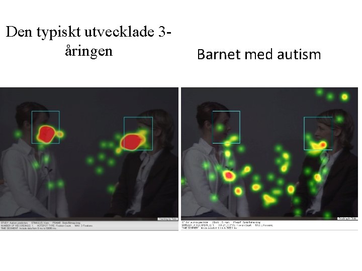 Den typiskt utvecklade 3åringen Barnet med autism 