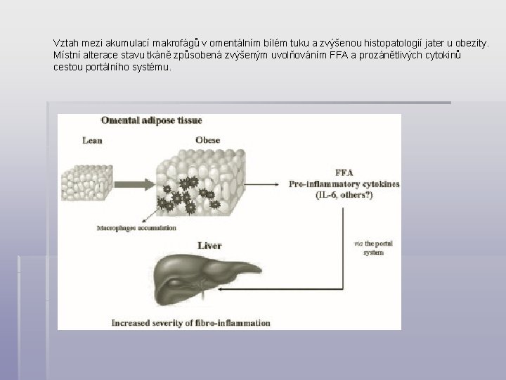 Vztah mezi akumulací makrofágů v omentálním bílém tuku a zvýšenou histopatologií jater u obezity.