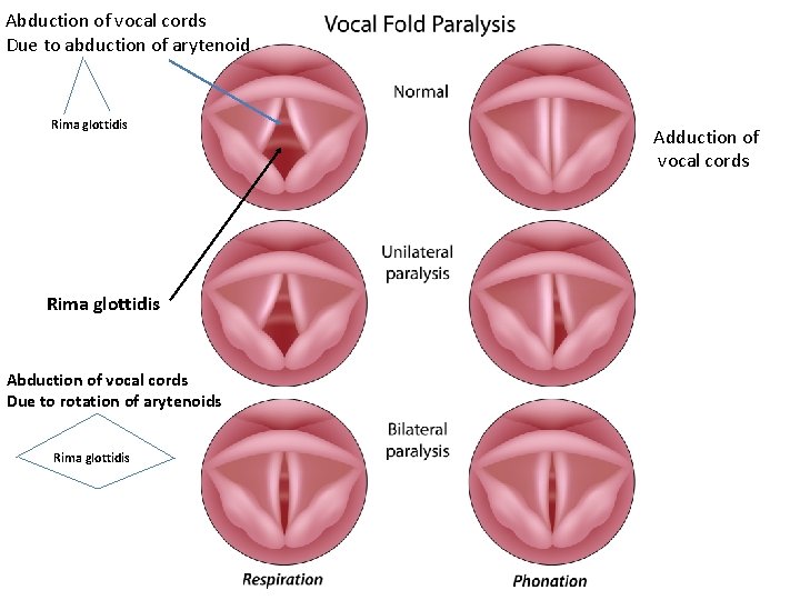 Abduction of vocal cords Due to abduction of arytenoid Rima glottidis Abduction of vocal