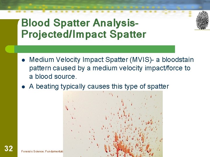 Blood Spatter Analysis. Projected/Impact Spatter l l 32 Medium Velocity Impact Spatter (MVIS)- a