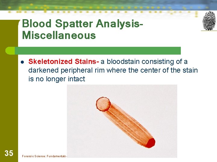 Blood Spatter Analysis. Miscellaneous l 35 Skeletonized Stains- a bloodstain consisting of a darkened