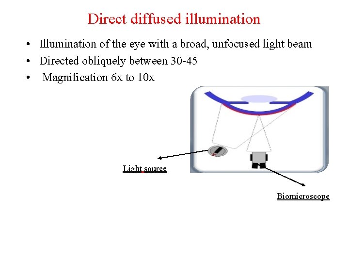 Direct diffused illumination • Illumination of the eye with a broad, unfocused light beam