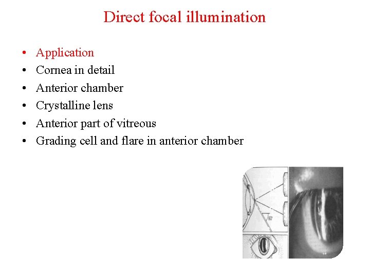 Direct focal illumination • • • Application Cornea in detail Anterior chamber Crystalline lens