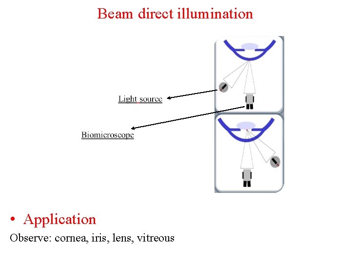 Beam direct illumination • Application Observe: cornea, iris, lens, vitreous 