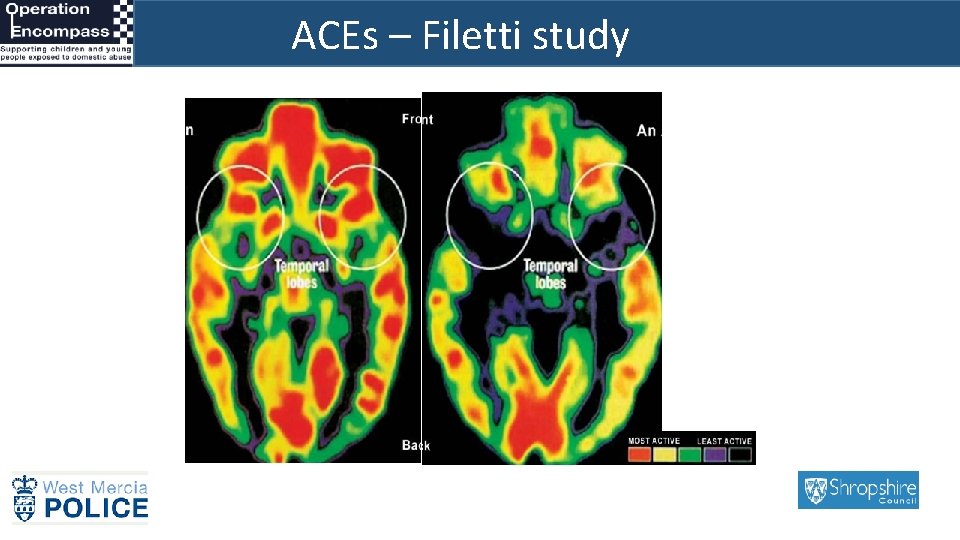 ACEs – Filetti study 3 x 