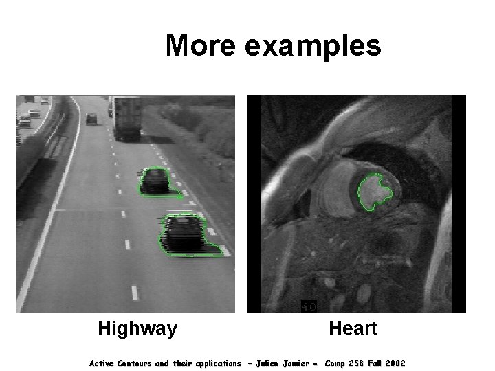 More examples Highway Heart Active Contours and their applications – Julien Jomier - Comp