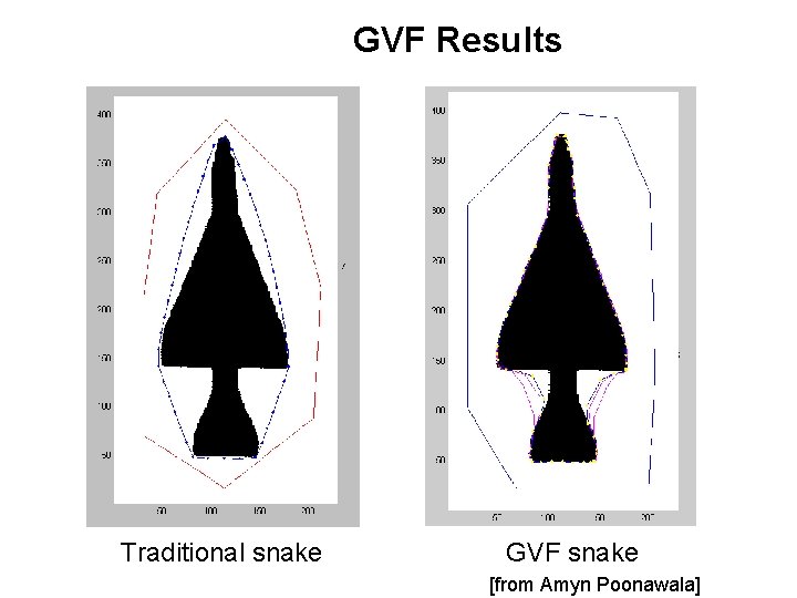 GVF Results Traditional snake GVF snake [from Amyn Poonawala] 