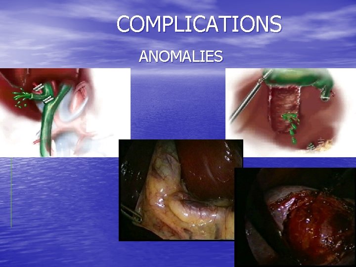 COMPLICATIONS ANOMALIES 