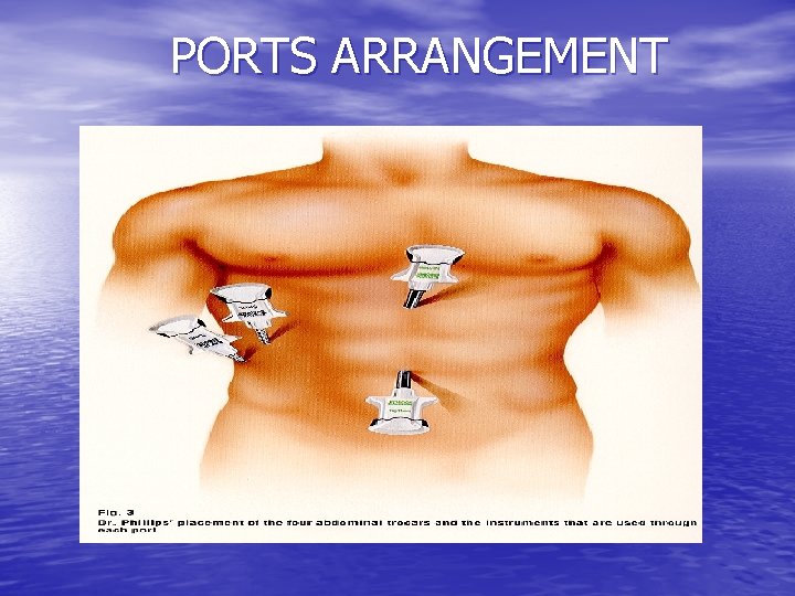 PORTS ARRANGEMENT 