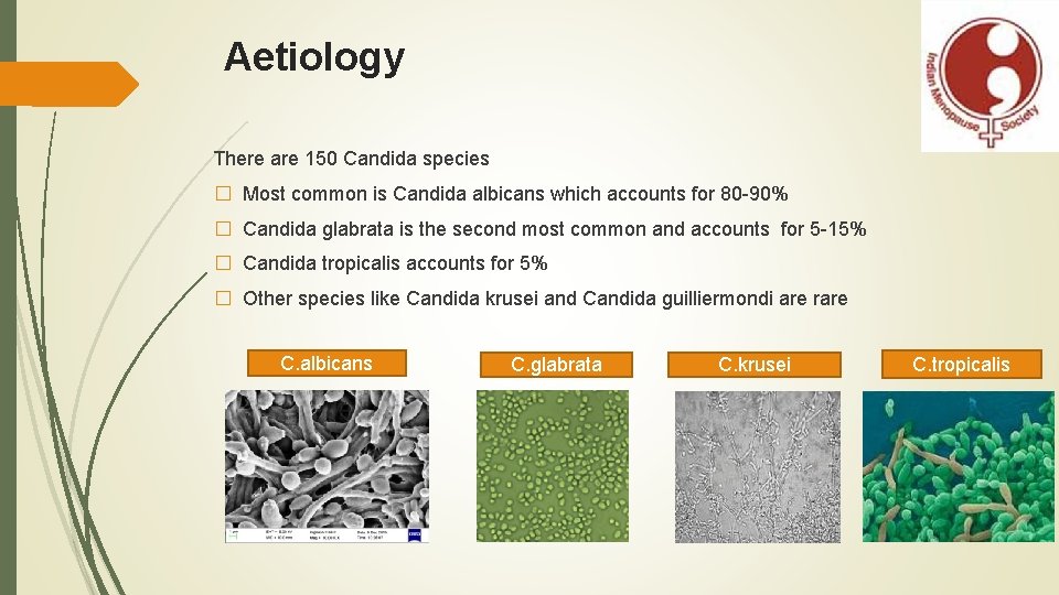 Aetiology There are 150 Candida species � Most common is Candida albicans which accounts