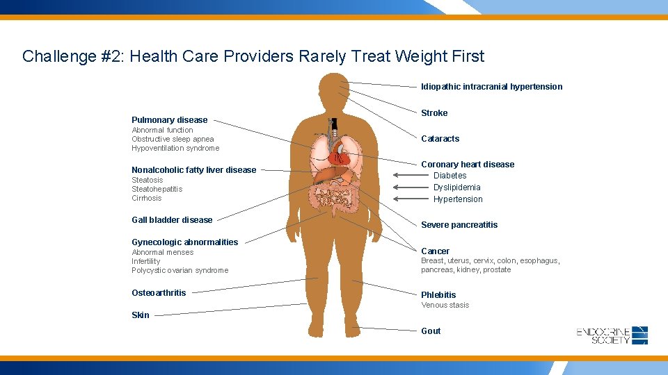 Challenge #2: Health Care Providers Rarely Treat Weight First Idiopathic intracranial hypertension Pulmonary disease