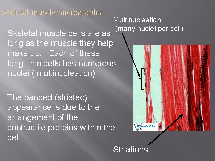 Skeletal muscle micrographs Multinucleation (many nuclei per cell) Skeletal muscle cells are as long