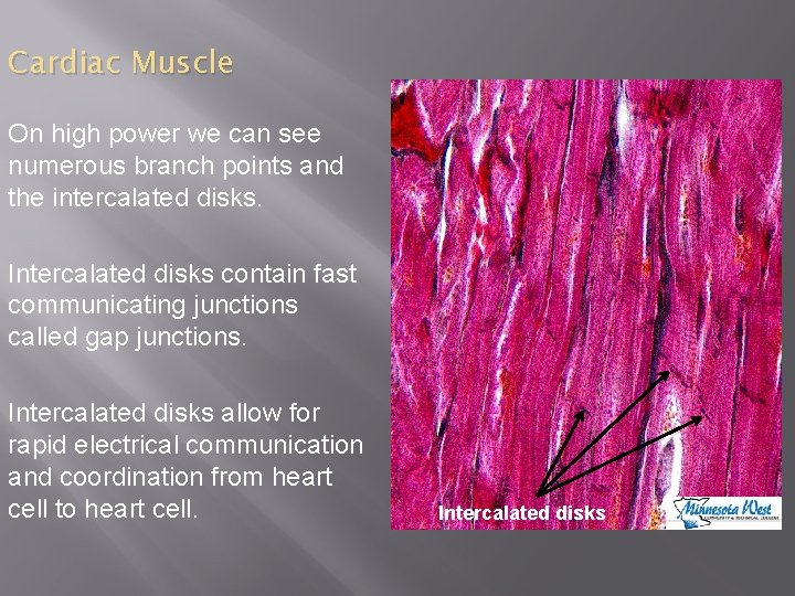 Cardiac Muscle On high power we can see numerous branch points and the intercalated