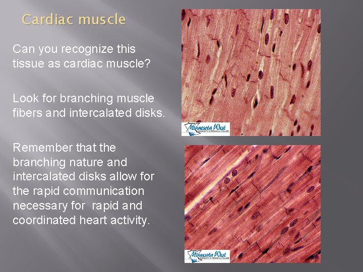 Cardiac muscle Can you recognize this tissue as cardiac muscle? Look for branching muscle