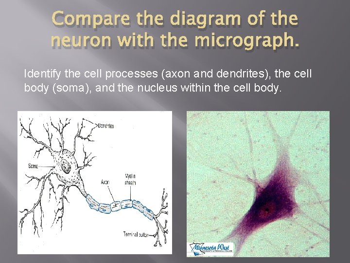 Compare the diagram of the neuron with the micrograph. Identify the cell processes (axon