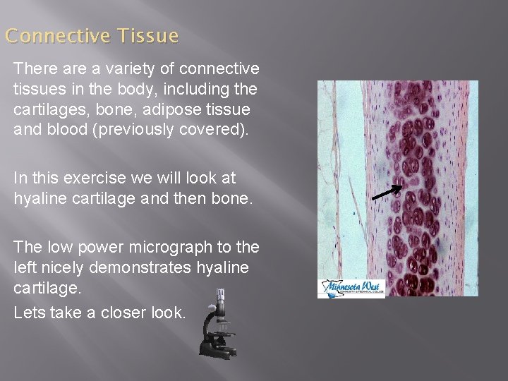Connective Tissue There a variety of connective tissues in the body, including the cartilages,
