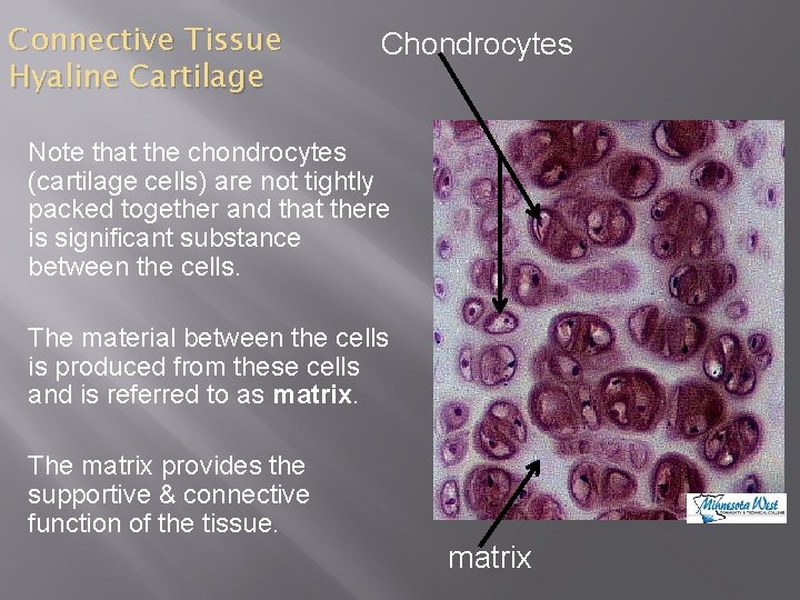 Connective Tissue Hyaline Cartilage Chondrocytes Note that the chondrocytes (cartilage cells) are not tightly