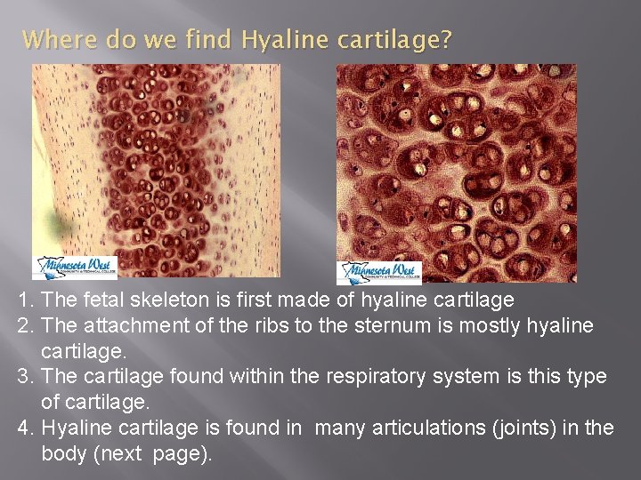 Where do we find Hyaline cartilage? 1. The fetal skeleton is first made of