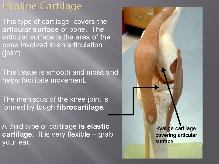 Hyaline Cartilage This type of cartilage covers the articular surface of bone. The articular