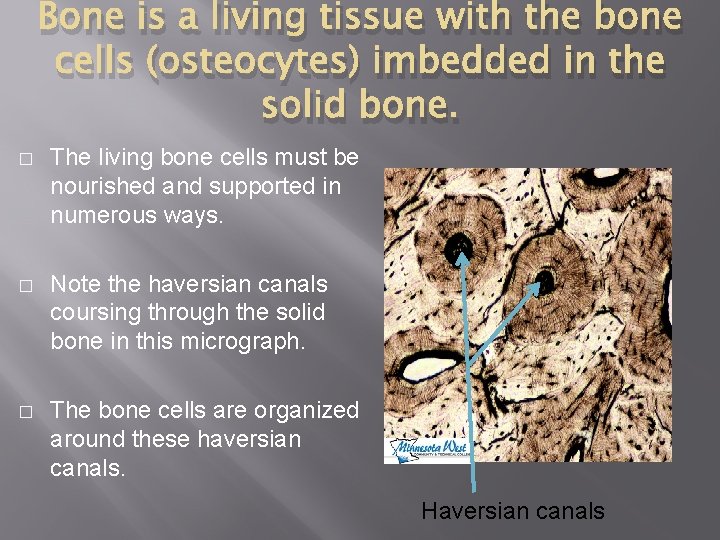 Bone is a living tissue with the bone cells (osteocytes) imbedded in the solid