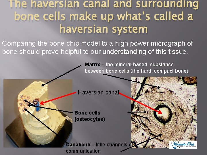 The haversian canal and surrounding bone cells make up what’s called a haversian system