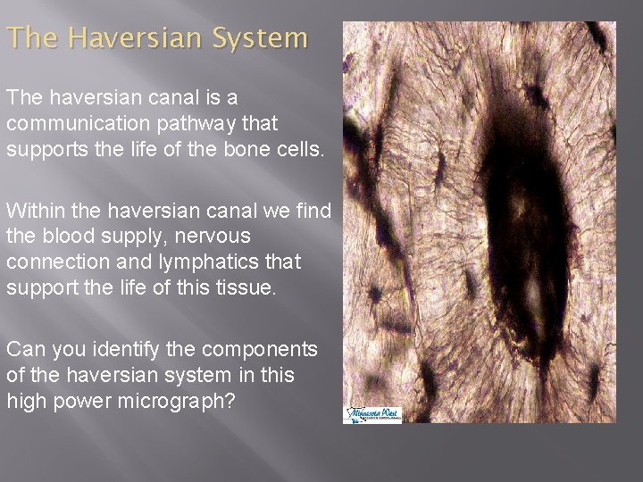 The Haversian System The haversian canal is a communication pathway that supports the life