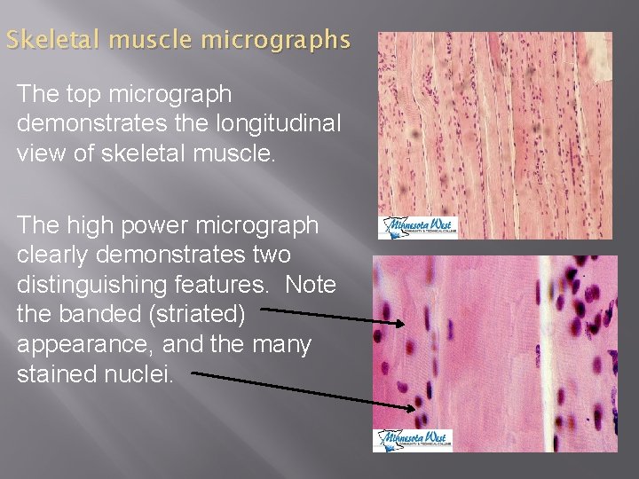 Skeletal muscle micrographs The top micrograph demonstrates the longitudinal view of skeletal muscle. The