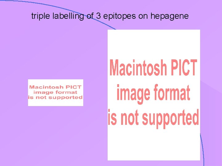 triple labelling of 3 epitopes on hepagene 