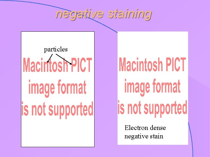 negative staining particles Electron dense negative stain 