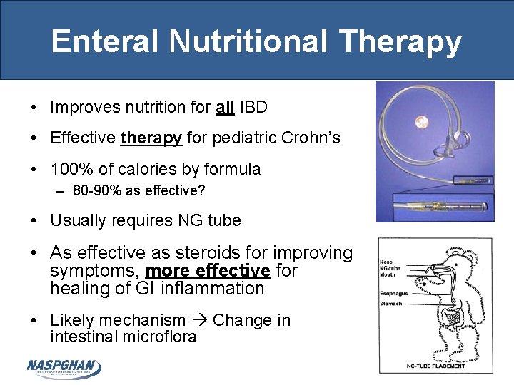 Enteral Nutritional Therapy • Improves nutrition for all IBD • Effective therapy for pediatric