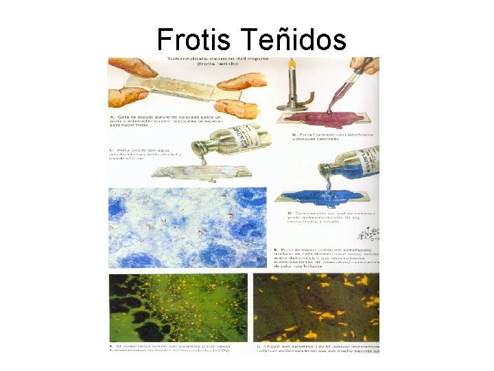 Frotis Teñidos 