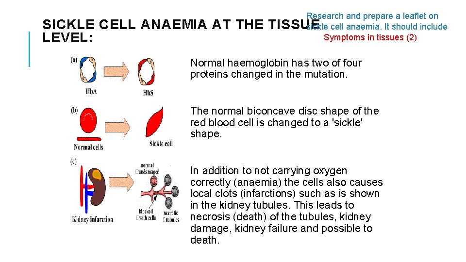 SICKLE CELL ANAEMIA AT THE LEVEL: Research and prepare a leaflet on TISSUE sickle
