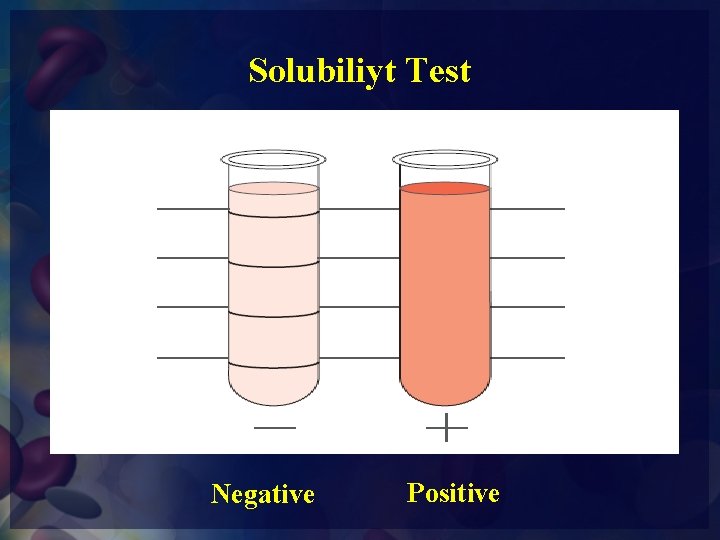 Solubiliyt Test Negative Positive 