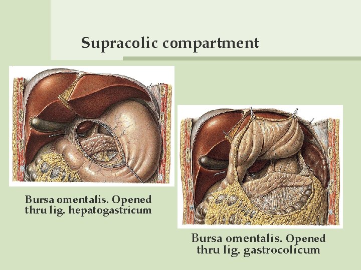 Supracolic compartment Bursa omentalis. Opened thru lig. hepatogastricum Bursa omentalis. Opened thru lig. gastrocolicum