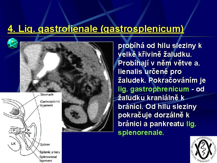 4. Lig. gastrolienale (gastrosplenicum) probíhá od hilu sleziny k velké křivině žaludku. Probíhají v