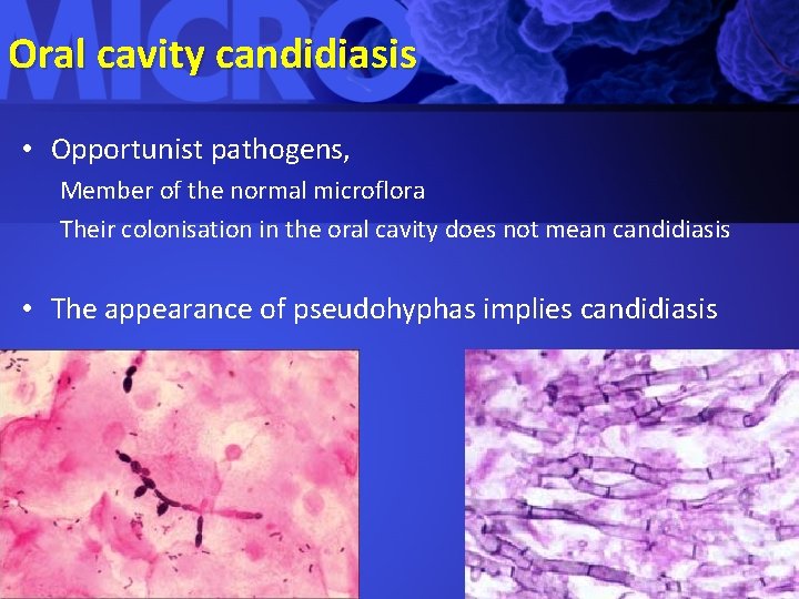 Oral cavity candidiasis • Opportunist pathogens, Member of the normal microflora Their colonisation in