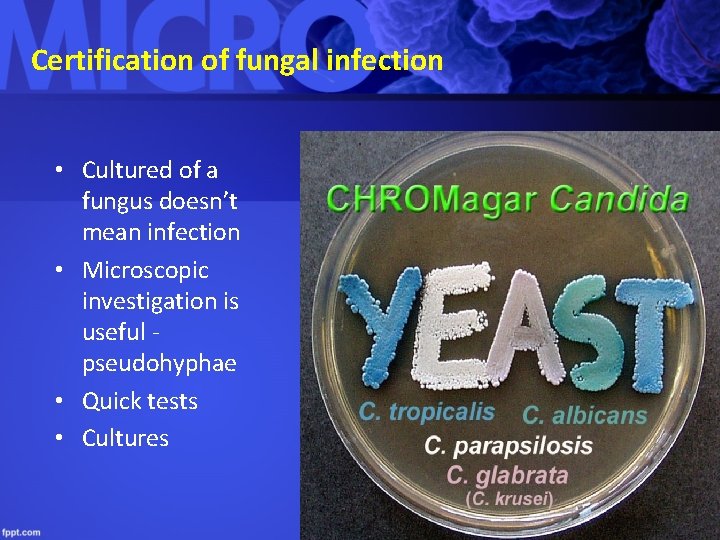 Certification of fungal infection • Cultured of a fungus doesn’t mean infection • Microscopic