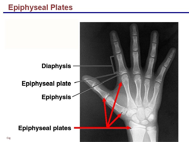 Epiphyseal Plates Copyright © 2004 Pearson Education, Inc. , publishing as Benjamin Cummings 