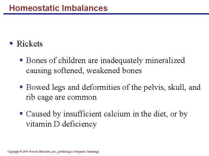 Homeostatic Imbalances § Rickets § Bones of children are inadequately mineralized causing softened, weakened