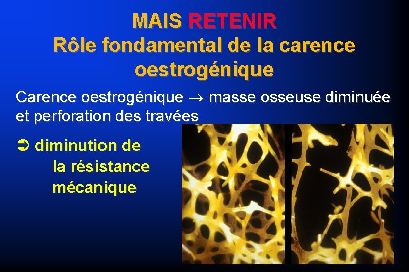 MAIS RETENIR Rôle fondamental de la carence oestrogénique Carence oestrogénique masse osseuse diminuée et