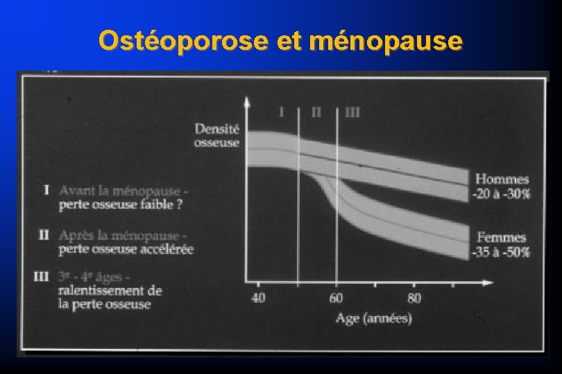 Ostéoporose et ménopause 