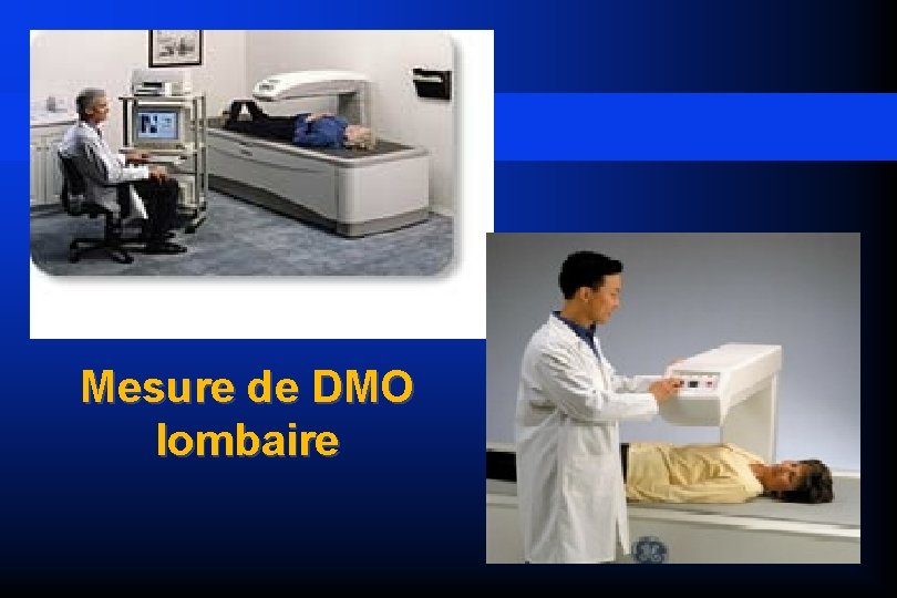 Mesure de DMO lombaire 