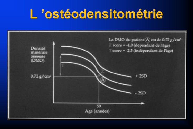 L ’ostéodensitométrie 