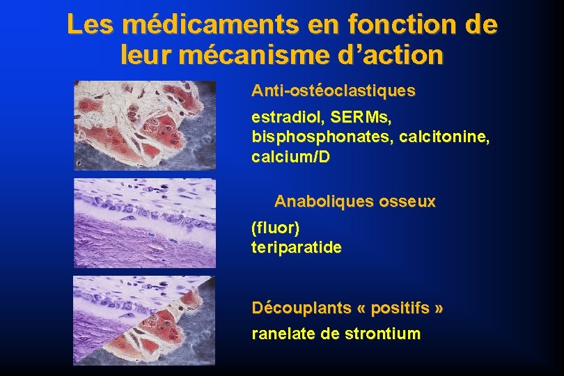 Les médicaments en fonction de leur mécanisme d’action Anti-ostéoclastiques estradiol, SERMs, bisphonates, calcitonine, calcium/D