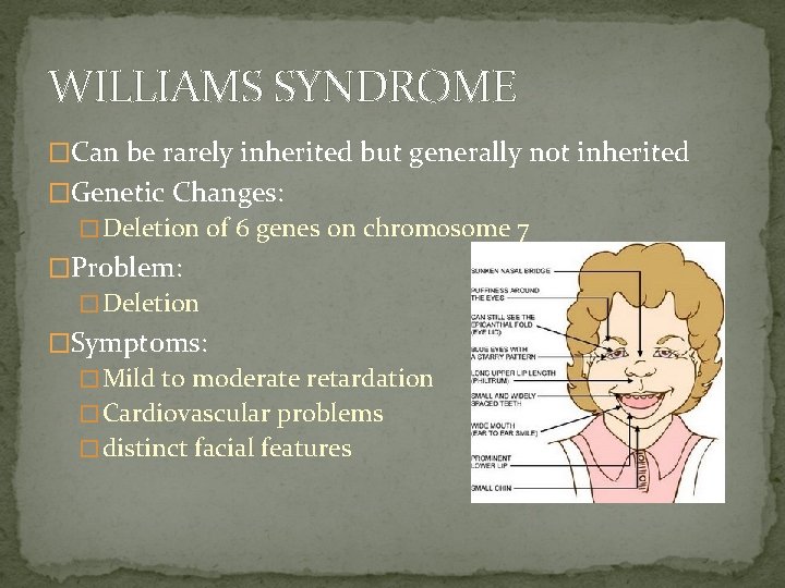 WILLIAMS SYNDROME �Can be rarely inherited but generally not inherited �Genetic Changes: �Deletion of