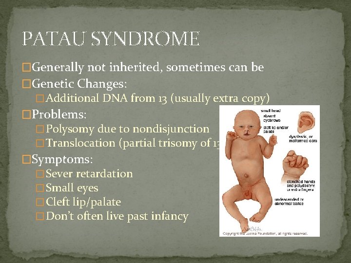 PATAU SYNDROME �Generally not inherited, sometimes can be �Genetic Changes: � Additional DNA from