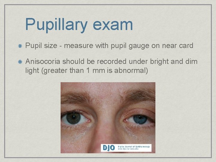 Pupillary exam Pupil size - measure with pupil gauge on near card Anisocoria should