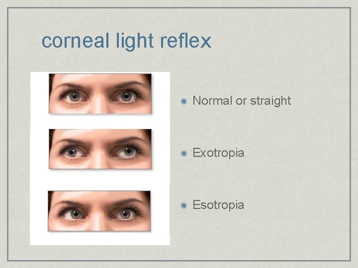 corneal light reflex Normal or straight Exotropia Esotropia 