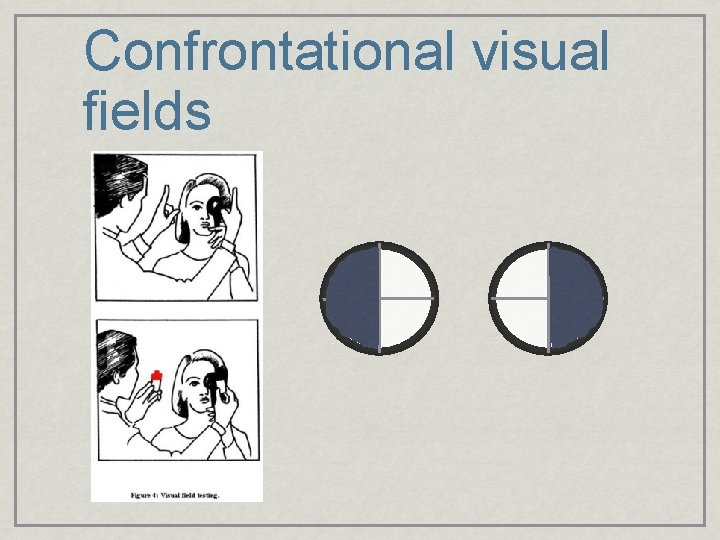 Confrontational visual fields 
