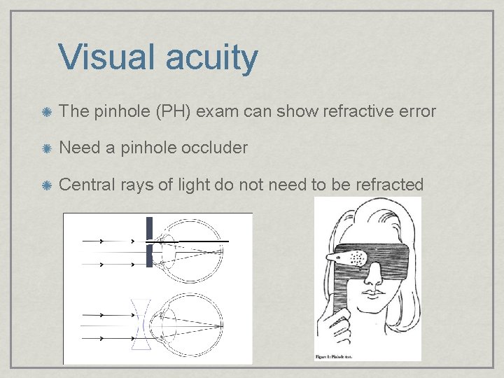 Visual acuity The pinhole (PH) exam can show refractive error Need a pinhole occluder